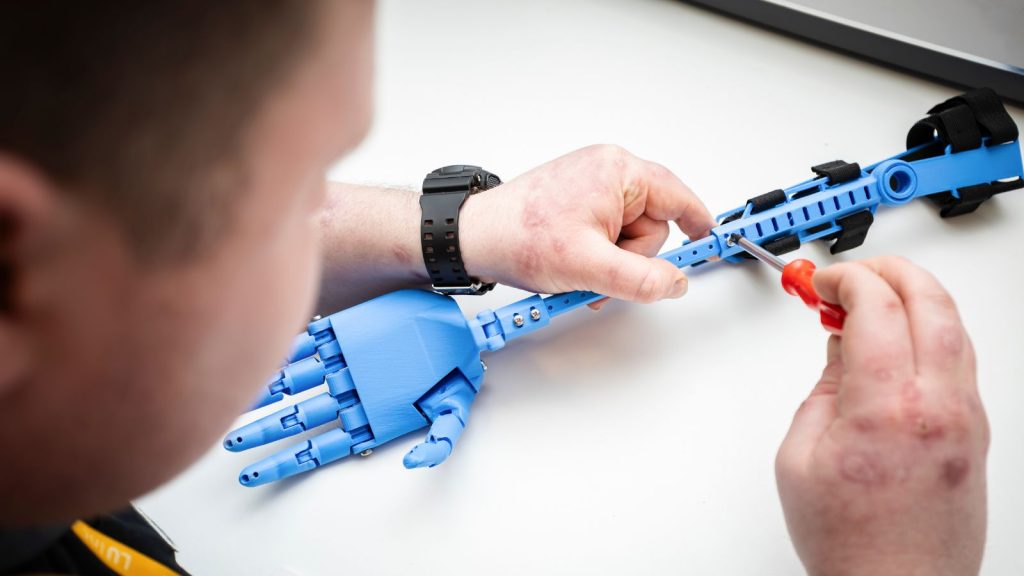 A close-up shot of Henry W inserting screws into a blue 3D-printed prosthetic arm.
